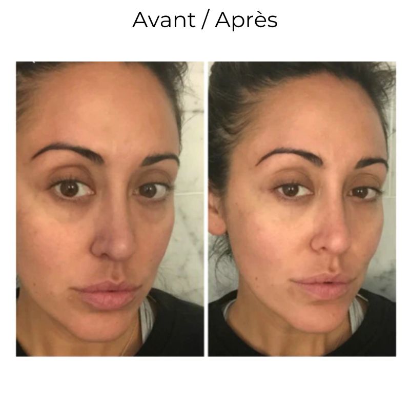 4 mois de cure Masque Collagène soluble + sérum vitamine C